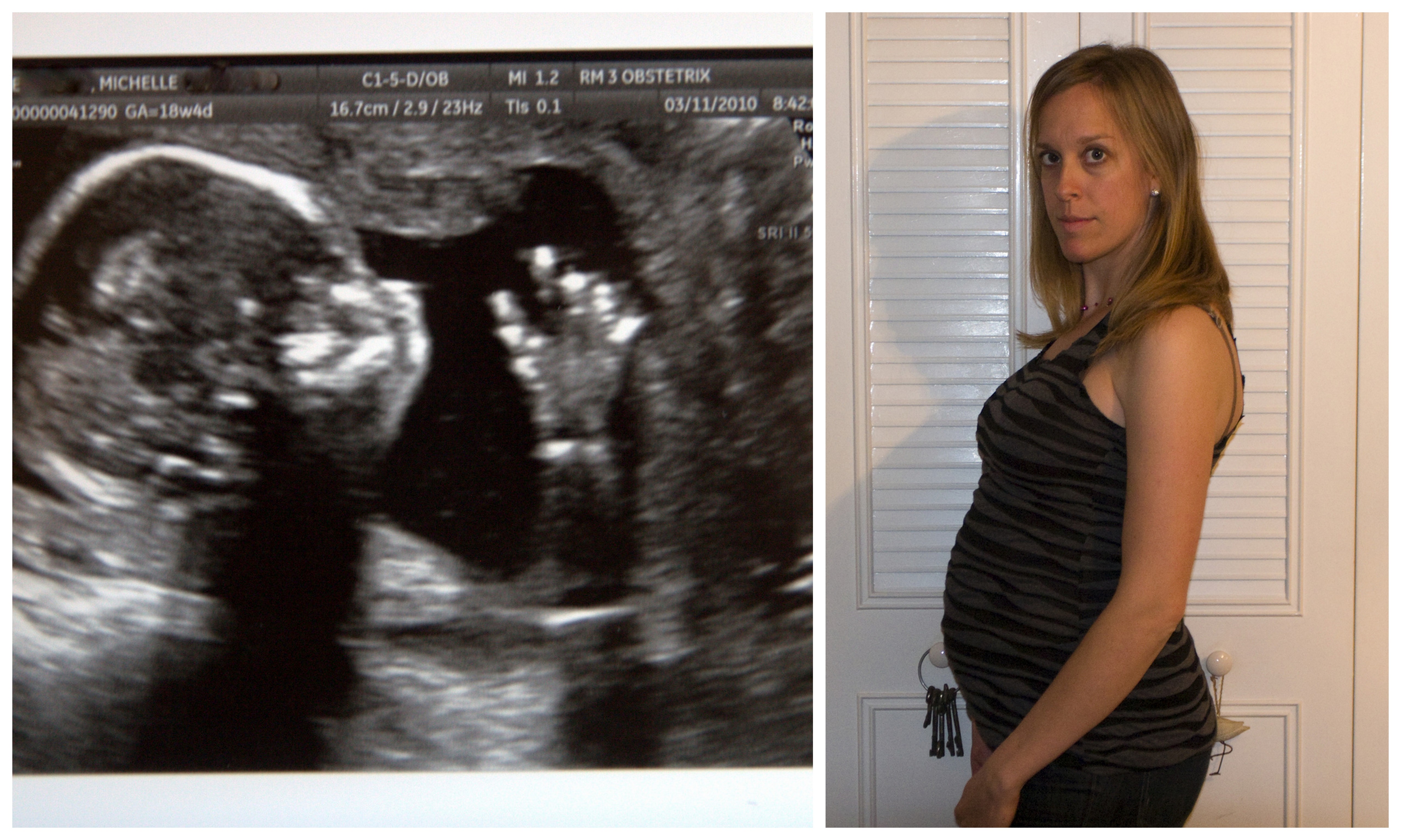 3/11 ultrasound, and 4/10 first profile after finding out the news